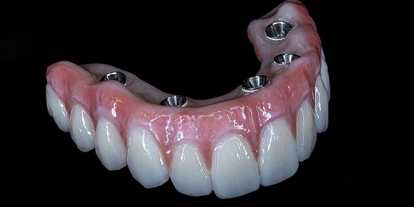 Acrylic Hybrid in Hyderabad