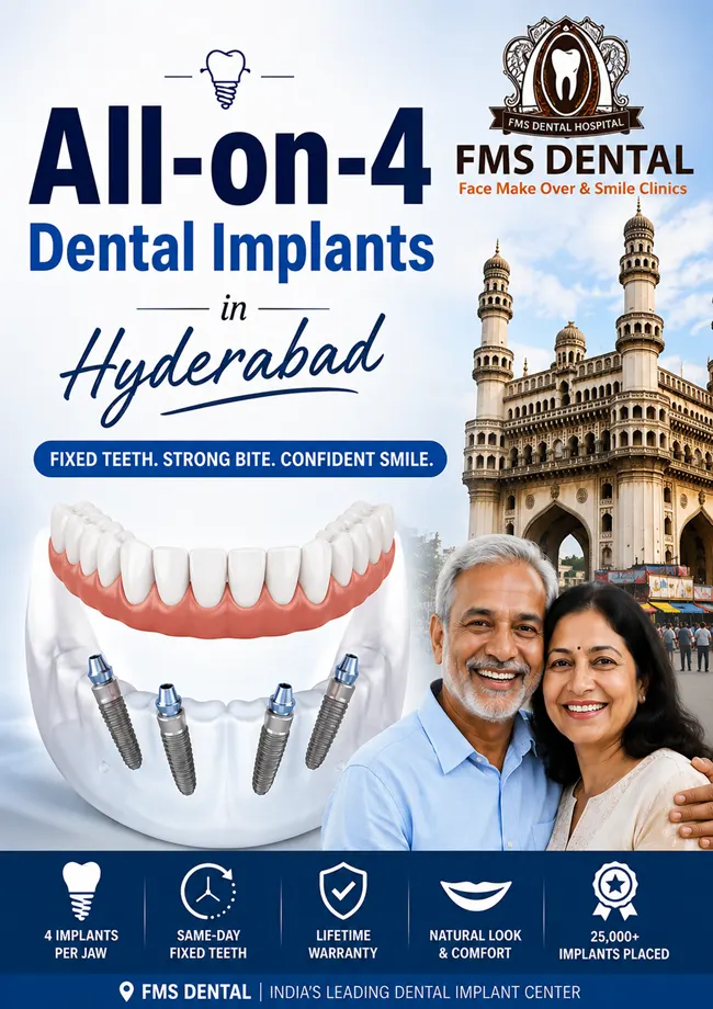 ALL-ON-4 Dental Implant in Hyderabad