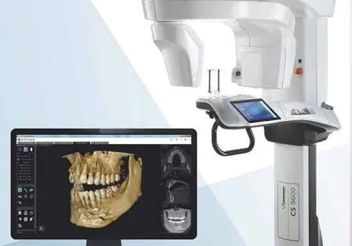 Diagnosis & CBCT/Digital X-Ray