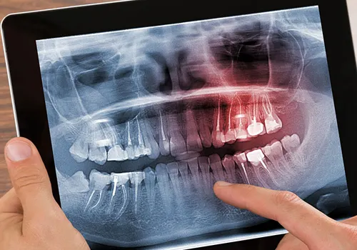 Digital Radiography