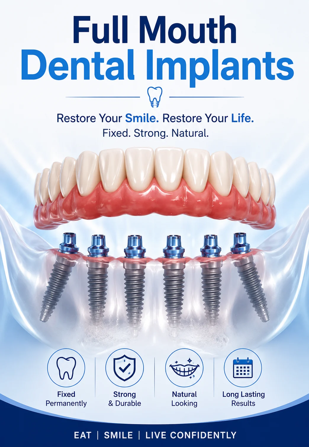 Full Mouth Dental Implant in Hyderabad