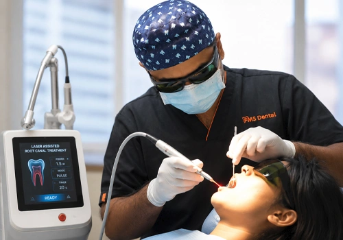  Laser Root Canal